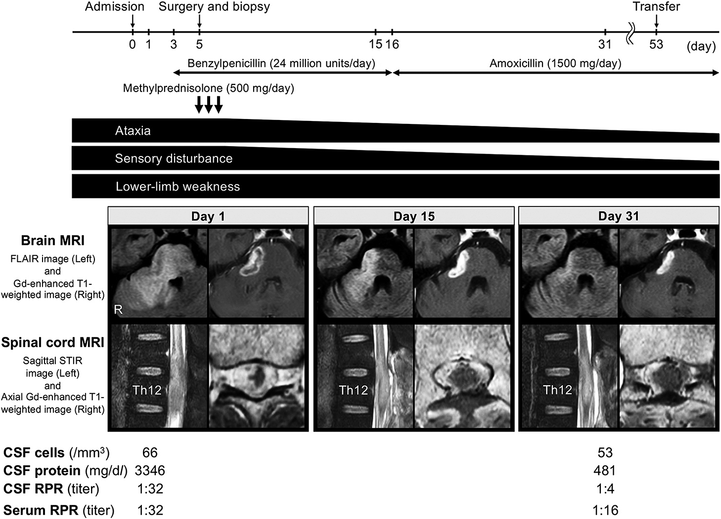 Syphilitic gummas affecting brain and spinal cord: a case report