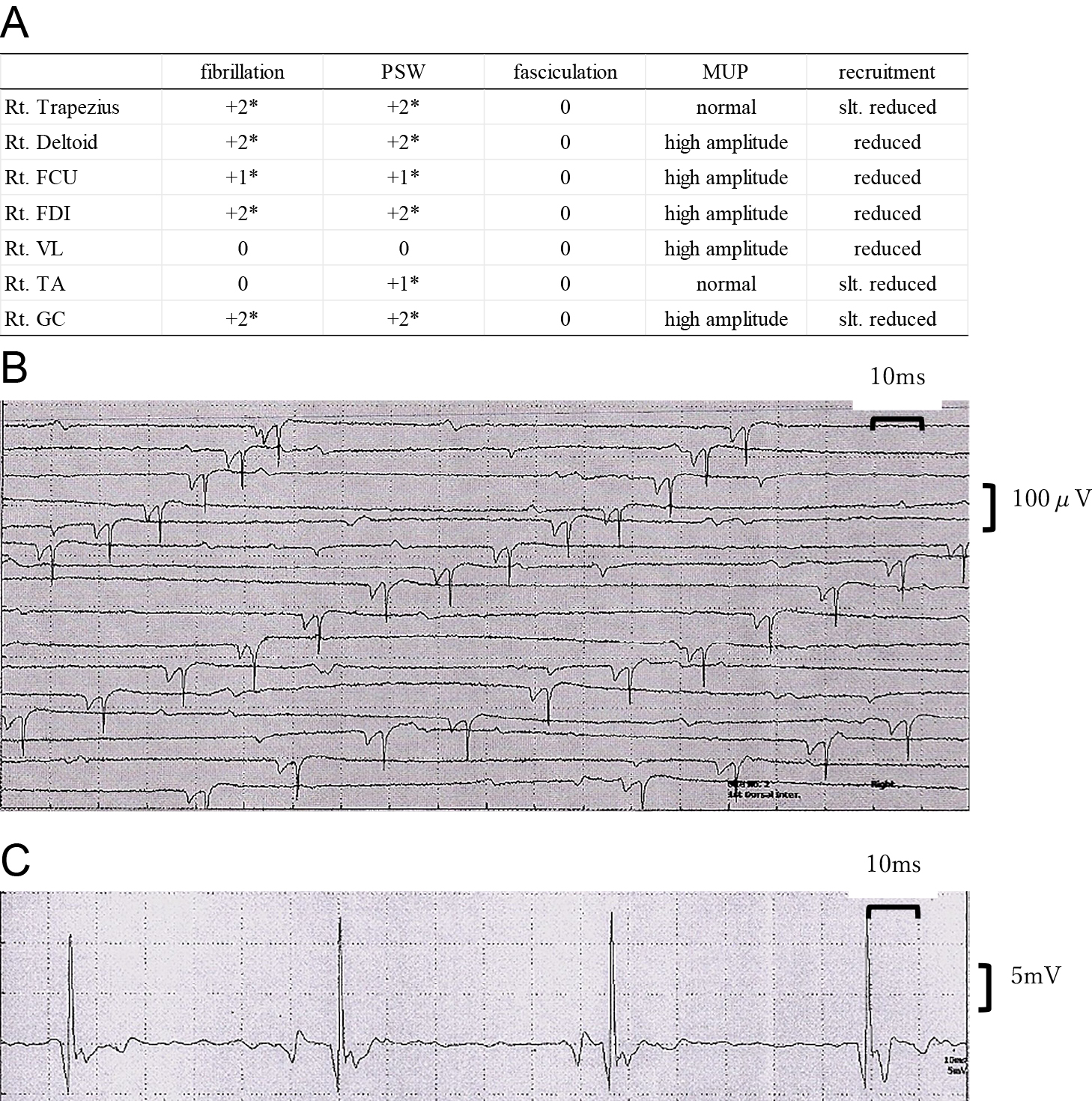 臨床神経生理学 医学文献検索サービス -メディカルオンライン