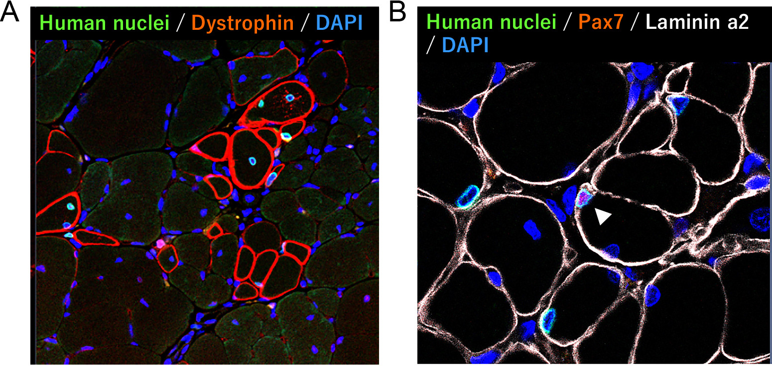 神経脈管学 胞巣状軟部肉腫のオンチップモデルにより血管新生メカニズムを