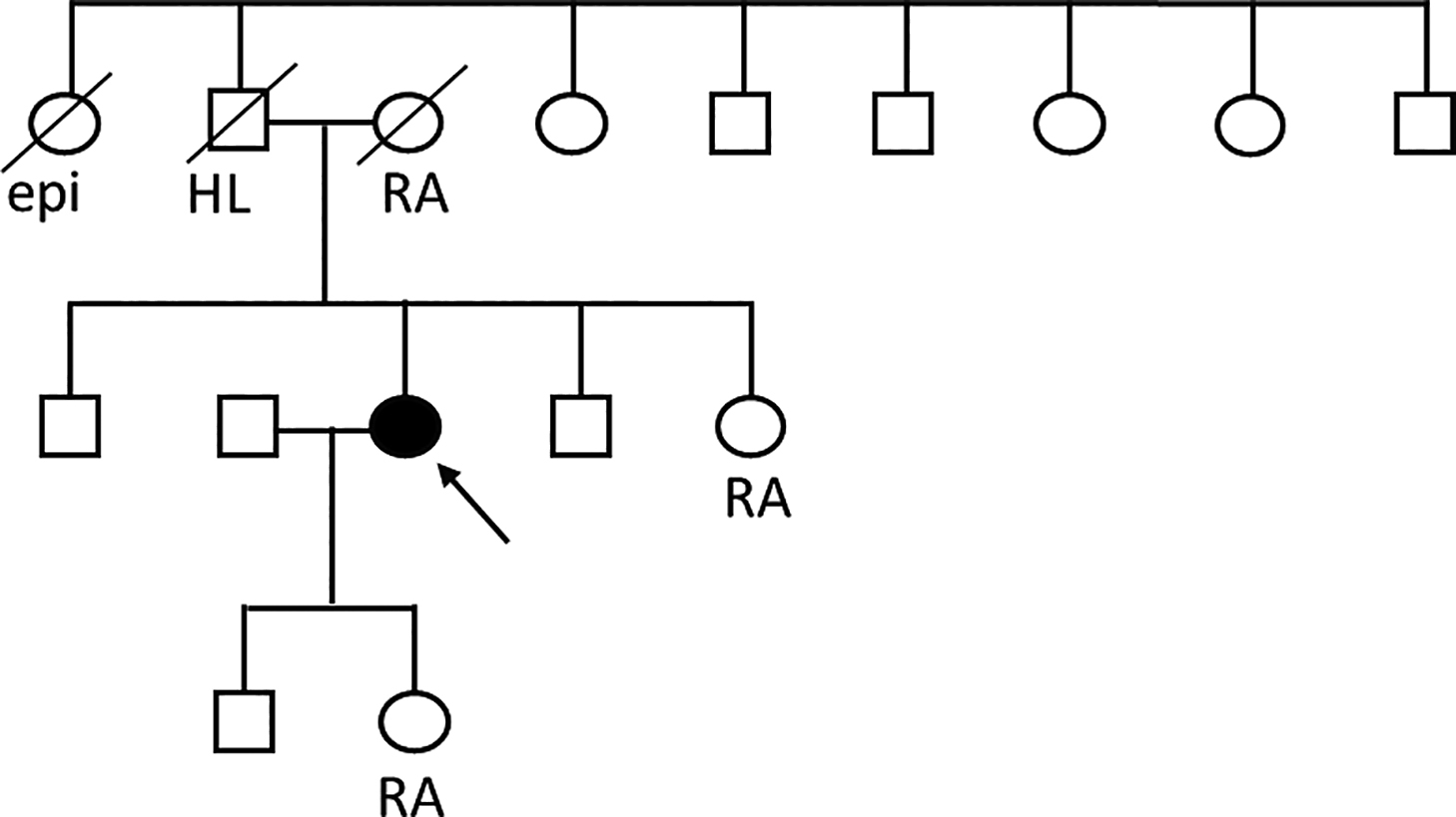 発症19年後に再検討を経て診断に至った神経核内封入体病の1例